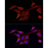 Immunofluorescence - Anti-DOK4 Antibody (A12554) - Antibodies.com