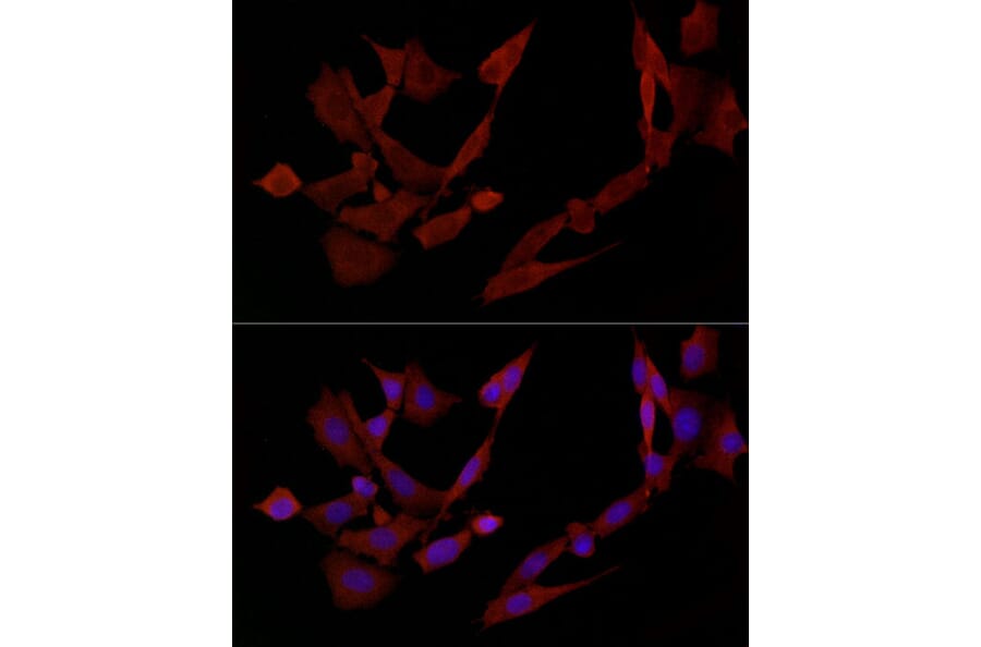 Immunofluorescence - Anti-DOK4 Antibody (A12554) - Antibodies.com