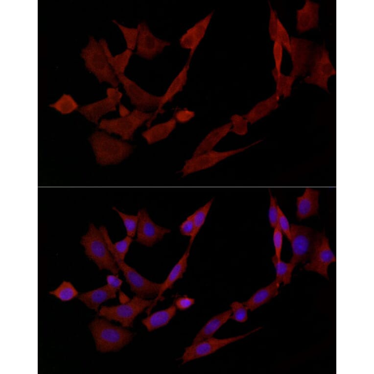 Immunofluorescence - Anti-DOK4 Antibody (A12554) - Antibodies.com
