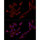 Immunofluorescence - Anti-DOK4 Antibody (A12554) - Antibodies.com