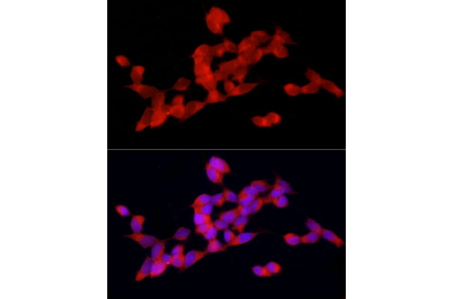 Immunofluorescence - Anti-DOK4 Antibody (A12554) - Antibodies.com