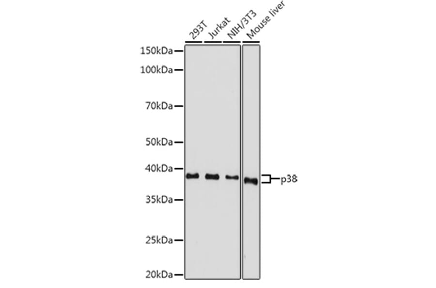 Western Blot - Anti-p38 alpha/MAPK14 Antibody (A12555) - Antibodies.com