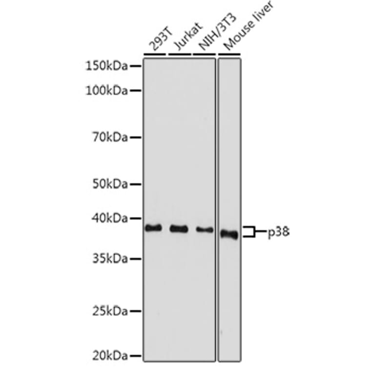 Western Blot - Anti-p38 alpha/MAPK14 Antibody (A12555) - Antibodies.com