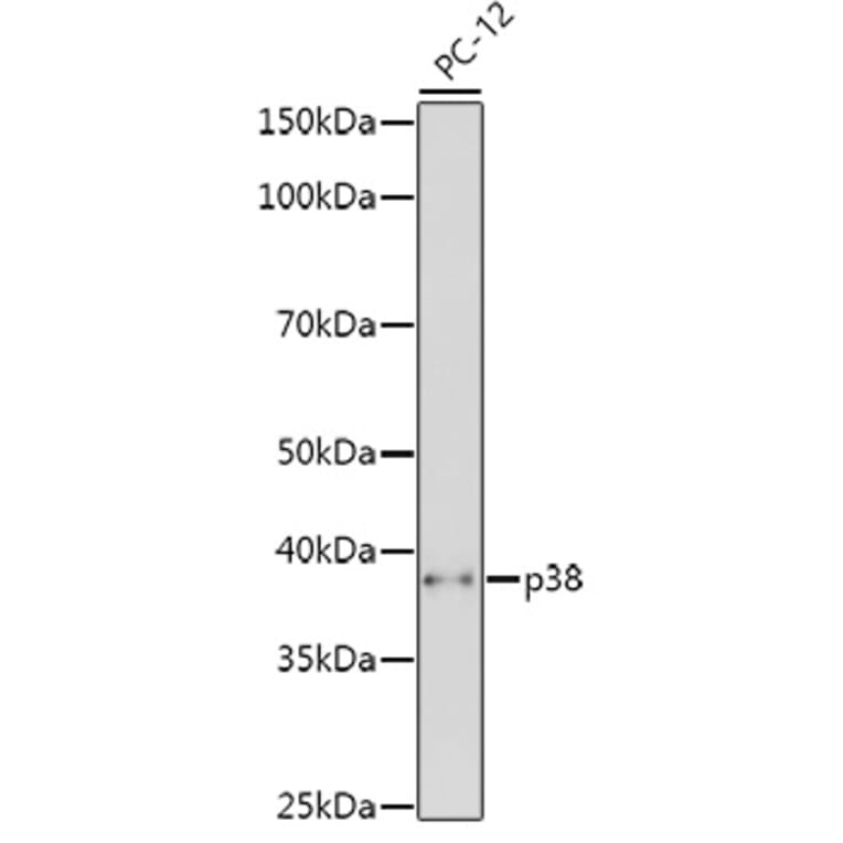 Western Blot - Anti-p38 alpha/MAPK14 Antibody (A12555) - Antibodies.com
