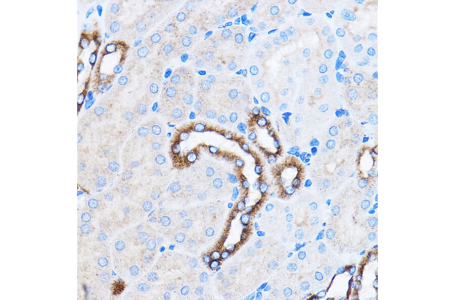 Immunohistochemistry - Anti-p38 alpha/MAPK14 Antibody (A12555) - Antibodies.com
