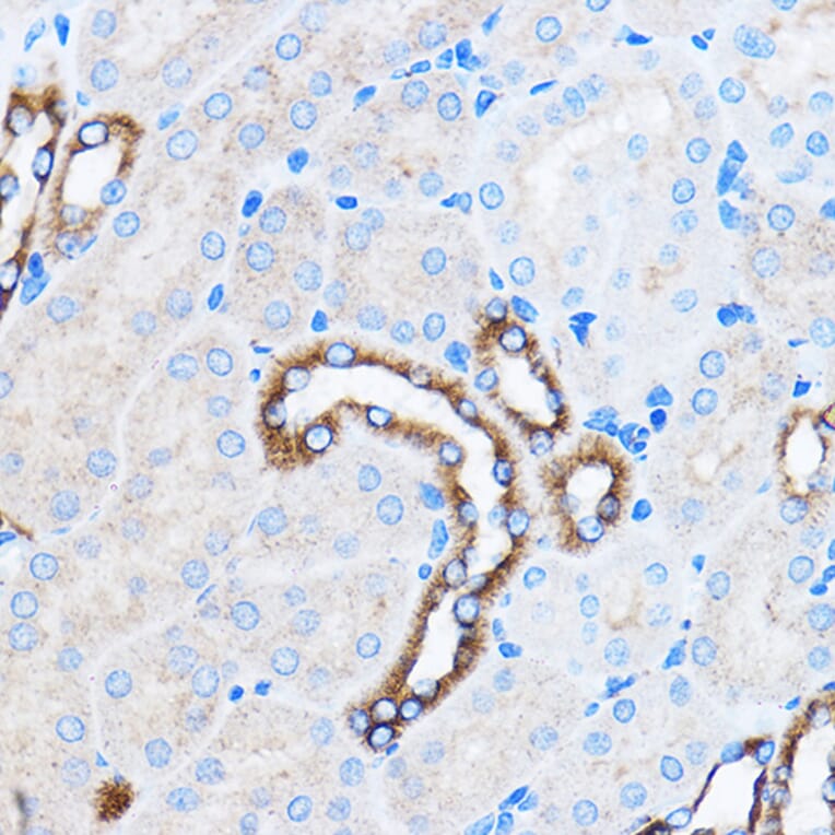Immunohistochemistry - Anti-p38 alpha/MAPK14 Antibody (A12555) - Antibodies.com