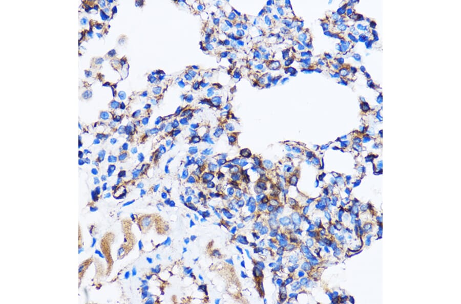 Immunohistochemistry - Anti-p38 alpha/MAPK14 Antibody (A12555) - Antibodies.com