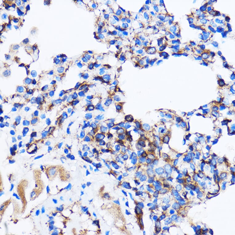 Immunohistochemistry - Anti-p38 alpha/MAPK14 Antibody (A12555) - Antibodies.com