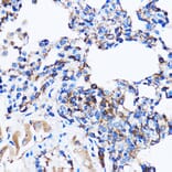 Immunohistochemistry - Anti-p38 alpha/MAPK14 Antibody (A12555) - Antibodies.com