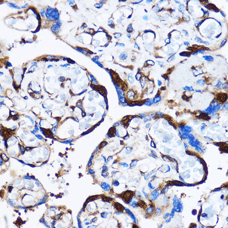 Immunohistochemistry - Anti-p38 alpha/MAPK14 Antibody (A12555) - Antibodies.com