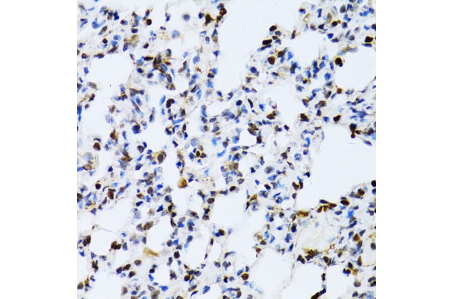 Immunohistochemistry - Anti-ERK1 Antibody (A12556) - Antibodies.com
