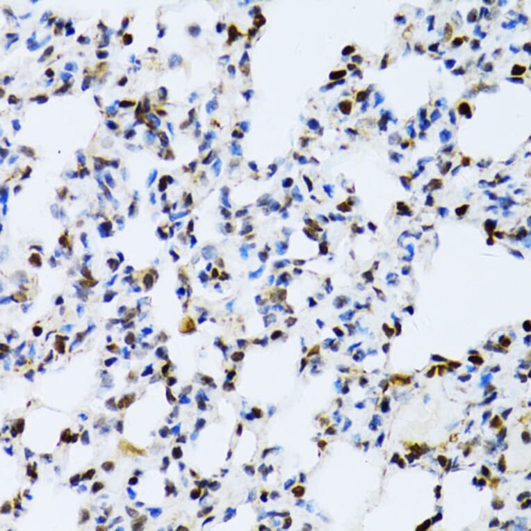 Immunohistochemistry - Anti-ERK1 Antibody (A12556) - Antibodies.com