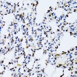 Immunohistochemistry - Anti-ERK1 Antibody (A12556) - Antibodies.com