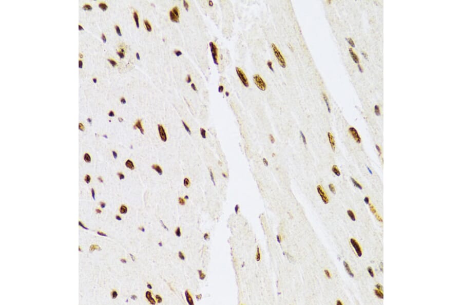 Immunohistochemistry - Anti-ERK1 Antibody (A12556) - Antibodies.com