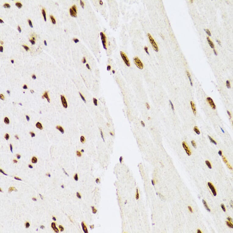 Immunohistochemistry - Anti-ERK1 Antibody (A12556) - Antibodies.com