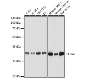 Western Blot - Anti-ERK2 Antibody (A12557) - Antibodies.com