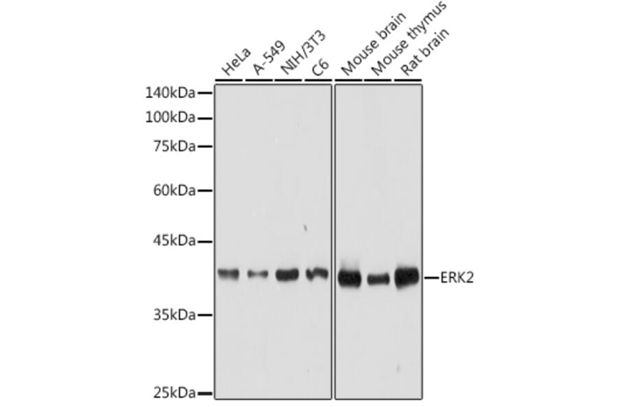 Western Blot - Anti-ERK2 Antibody (A12557) - Antibodies.com