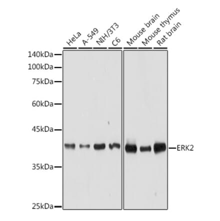 Western Blot - Anti-ERK2 Antibody (A12557) - Antibodies.com