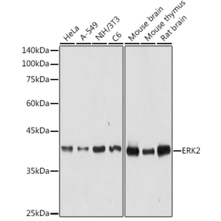 Western Blot - Anti-ERK2 Antibody (A12557) - Antibodies.com