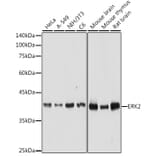 Western Blot - Anti-ERK2 Antibody (A12557) - Antibodies.com
