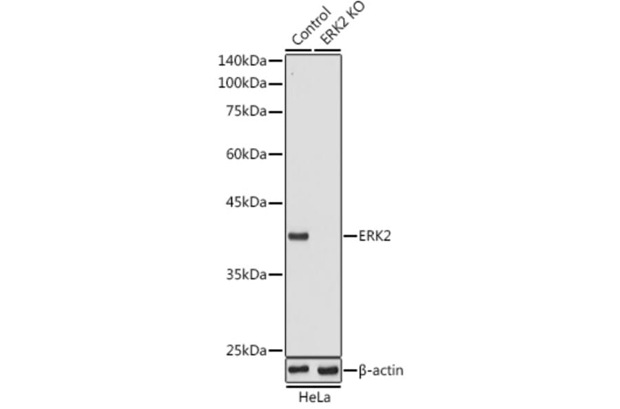 Western Blot - Anti-ERK2 Antibody (A12557) - Antibodies.com