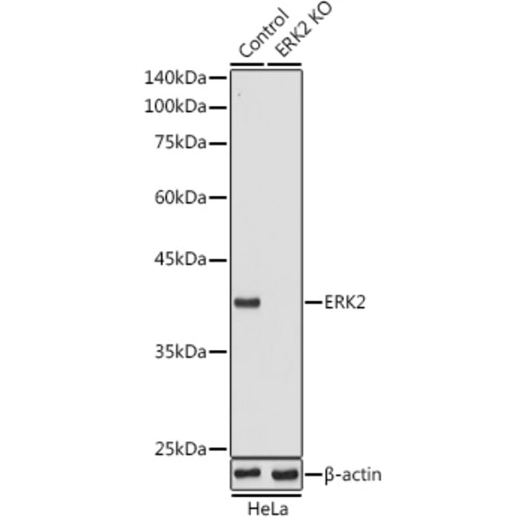 Western Blot - Anti-ERK2 Antibody (A12557) - Antibodies.com