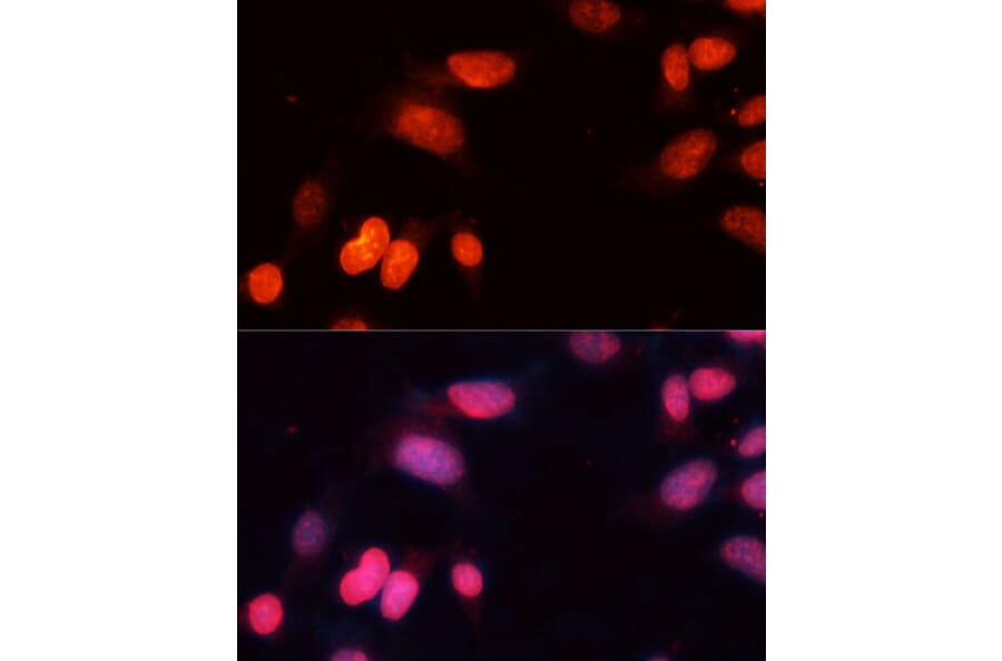 Immunofluorescence - Anti-SIRT1 Antibody (A12558) - Antibodies.com