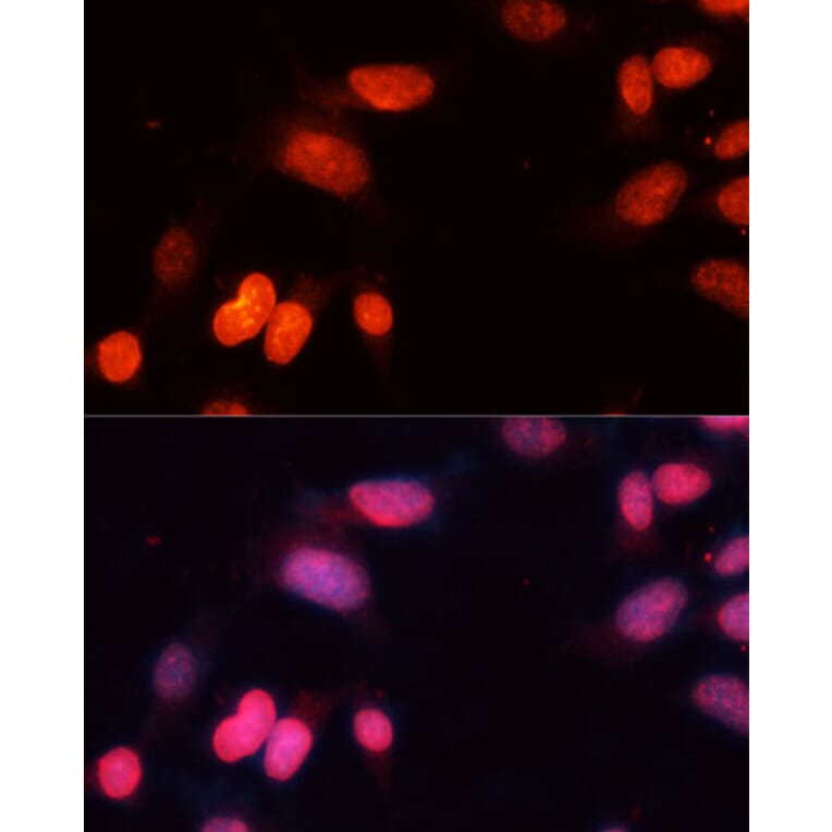 Immunofluorescence - Anti-SIRT1 Antibody (A12558) - Antibodies.com