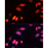 Immunofluorescence - Anti-SIRT1 Antibody (A12558) - Antibodies.com