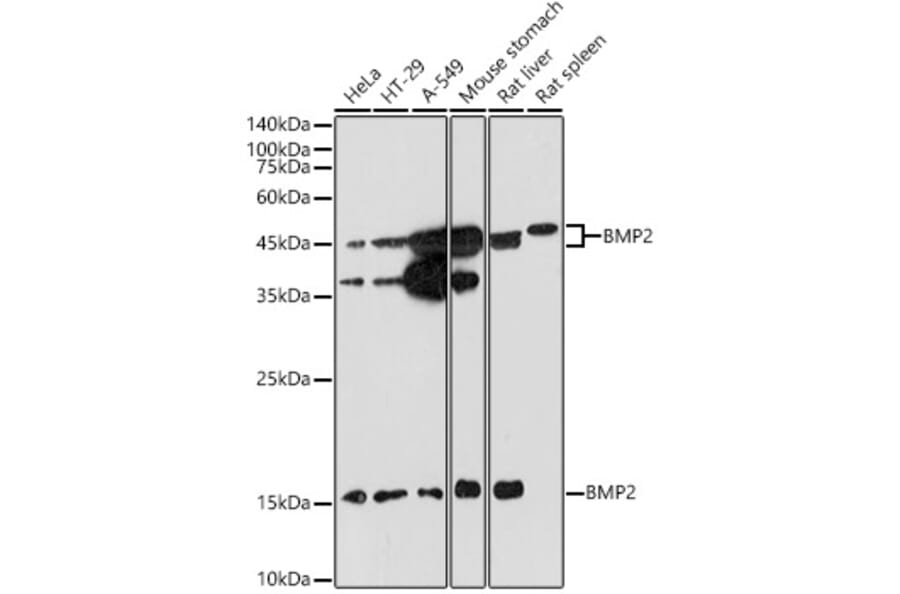 Western Blot - Anti-BMP2 Antibody (A12559) - Antibodies.com