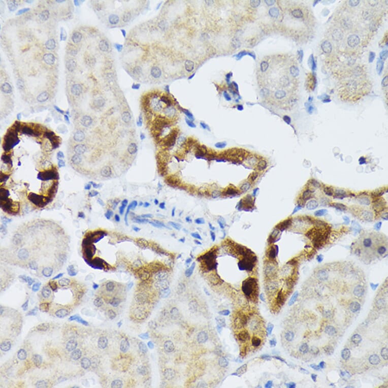 Immunohistochemistry - Anti-BMP2 Antibody (A12559) - Antibodies.com