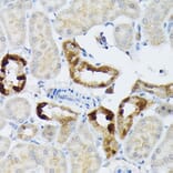 Immunohistochemistry - Anti-BMP2 Antibody (A12559) - Antibodies.com