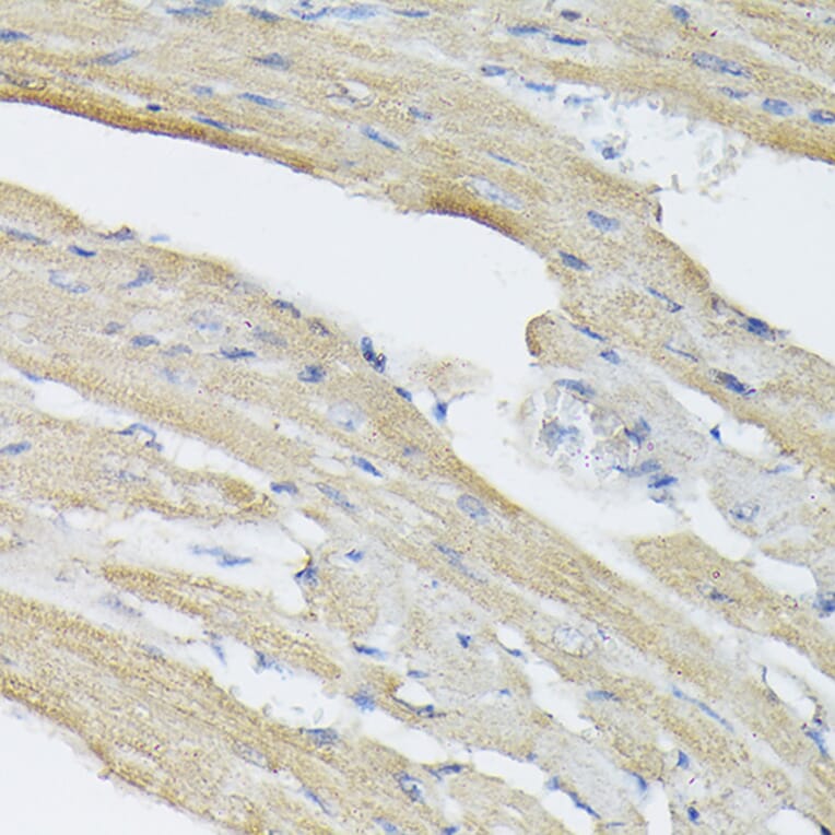 Immunohistochemistry - Anti-BMP2 Antibody (A12559) - Antibodies.com