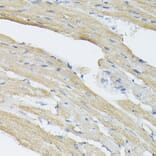 Immunohistochemistry - Anti-BMP2 Antibody (A12559) - Antibodies.com