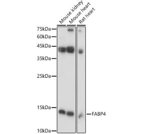 Western Blot - Anti-FABP4 Antibody (A12560) - Antibodies.com