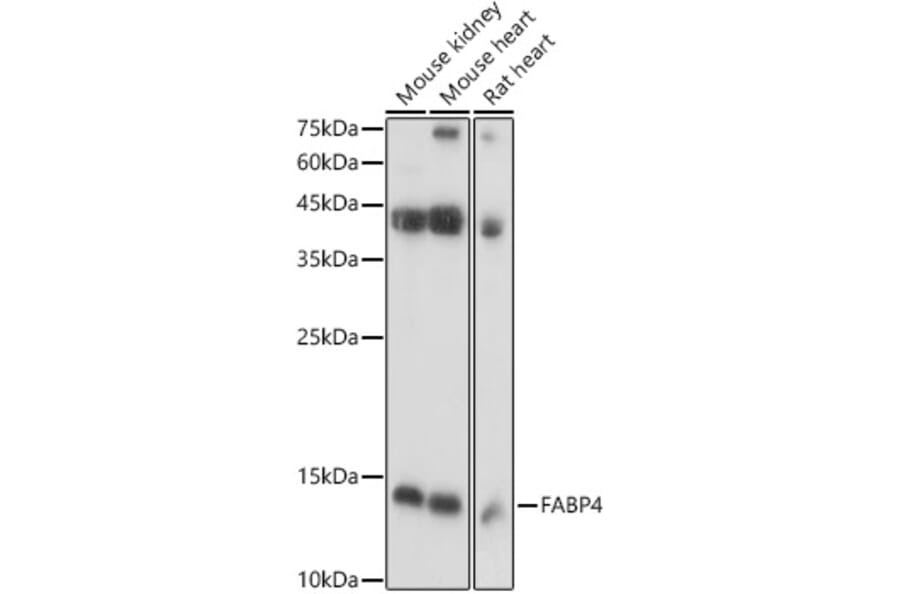 Western Blot - Anti-FABP4 Antibody (A12560) - Antibodies.com