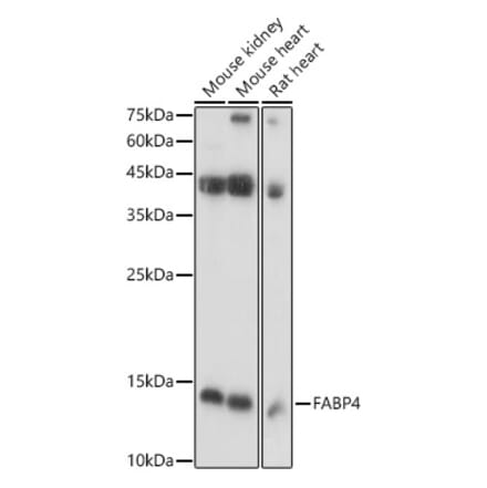 Western Blot - Anti-FABP4 Antibody (A12560) - Antibodies.com