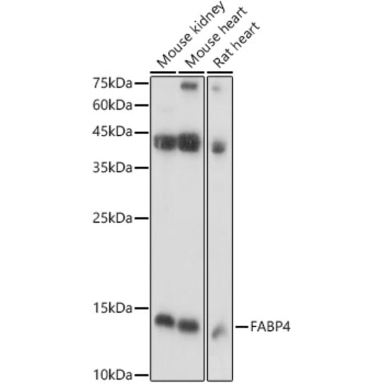 Western Blot - Anti-FABP4 Antibody (A12560) - Antibodies.com