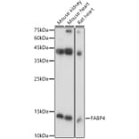 Western Blot - Anti-FABP4 Antibody (A12560) - Antibodies.com