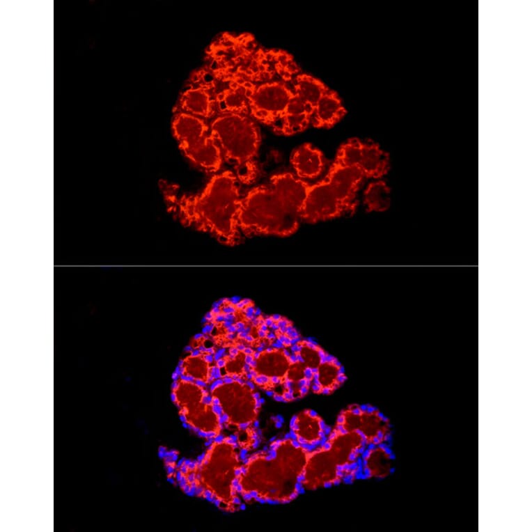 Immunofluorescence - Anti-FABP4 Antibody (A12560) - Antibodies.com