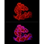 Immunofluorescence - Anti-FABP4 Antibody (A12560) - Antibodies.com