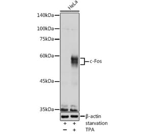Western Blot - Anti-c-Fos Antibody (A12562) - Antibodies.com