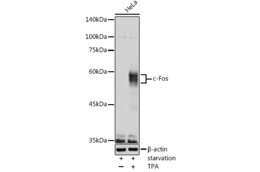 Western Blot - Anti-c-Fos Antibody (A12562) - Antibodies.com