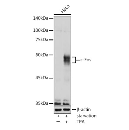 Western Blot - Anti-c-Fos Antibody (A12562) - Antibodies.com