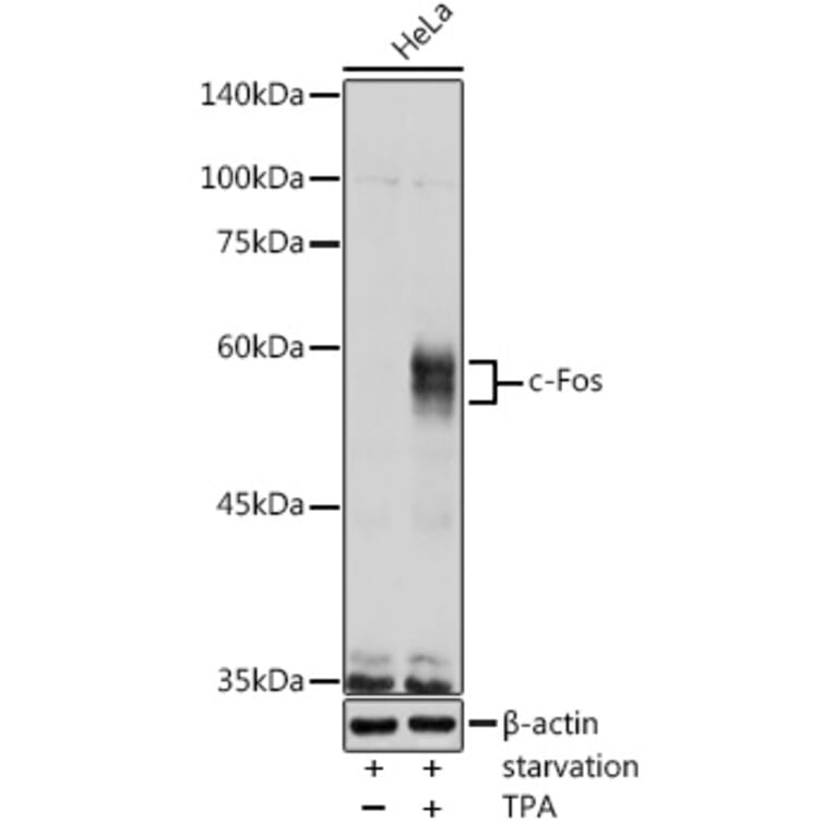 Western Blot - Anti-c-Fos Antibody (A12562) - Antibodies.com