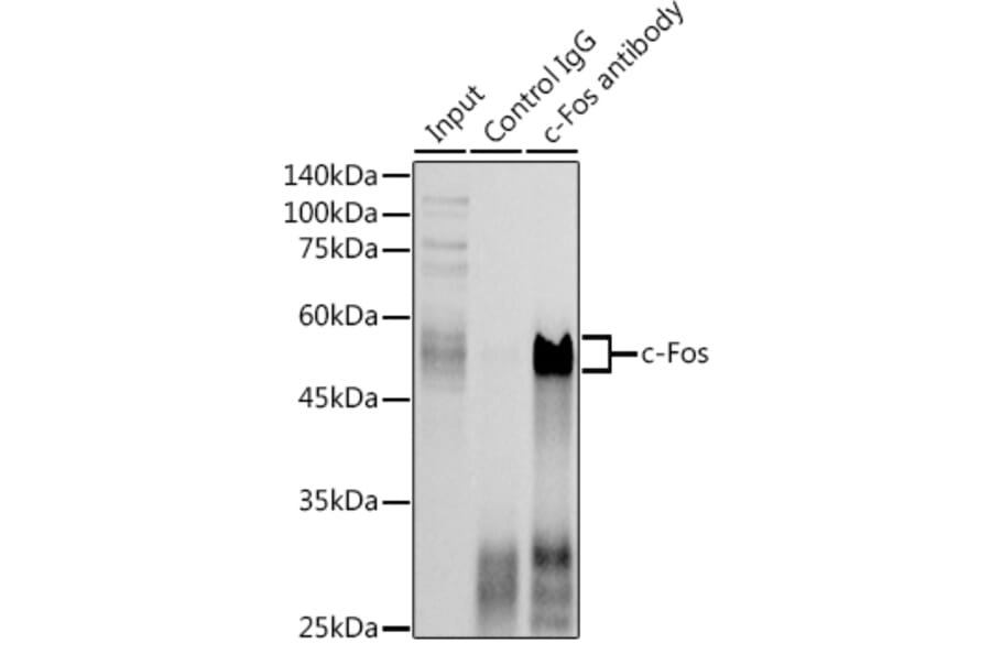 Western Blot - Anti-c-Fos Antibody (A12562) - Antibodies.com