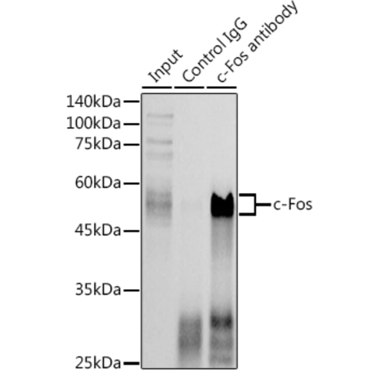 Western Blot - Anti-c-Fos Antibody (A12562) - Antibodies.com