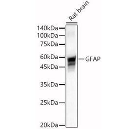 Western Blot - Anti-GFAP Antibody (A12563) - Antibodies.com