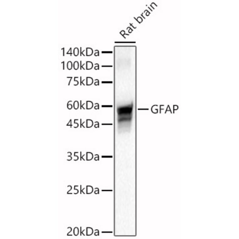 Western Blot - Anti-GFAP Antibody (A12563) - Antibodies.com