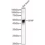Western Blot - Anti-GFAP Antibody (A12563) - Antibodies.com
